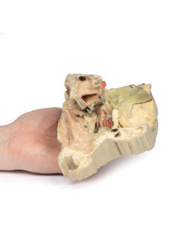 Órbita medial - Erler Zimmer 3D anatomy Series...