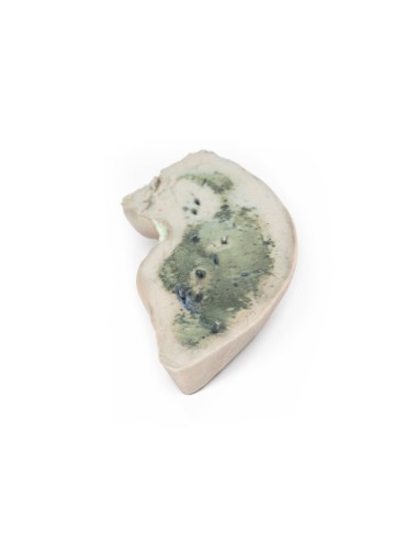 Fatty Liver - Erler Zimmer 3D anatomy Series...