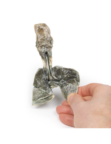 Fistola tracheoesofagea e atresia esofagea - Erler Zimmer 3D anatomy Series MP2059