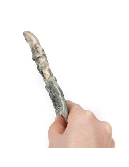 Fistola tracheoesofagea e atresia esofagea - Erler Zimmer 3D anatomy Series MP2059