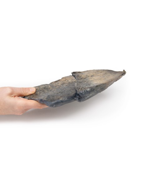 Broncopolmonite - Erler Zimmer 3D anatomy Series MP2058