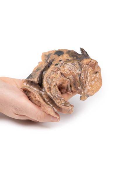 Corps étranger inhalé : trachée - Erler Zimmer 3D anatomy Series MP2053