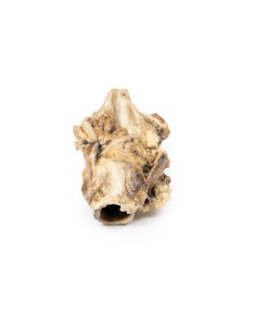 Carcinoma of the piriform fossa - Erler Zimmer 3D anatomy...