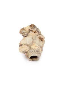 Carcinoma of the piriform fossa - Erler Zimmer 3D anatomy... 2