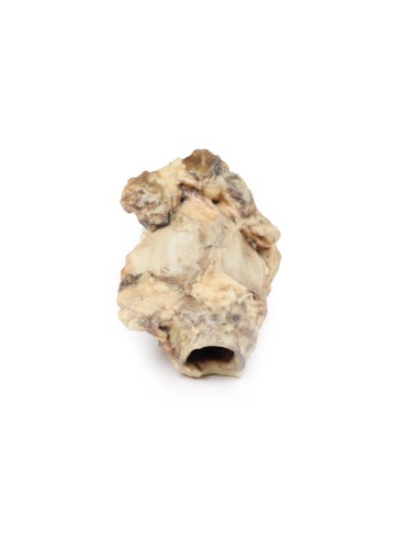 Carcinoma de la fosa piriforme - Erler Zimmer...