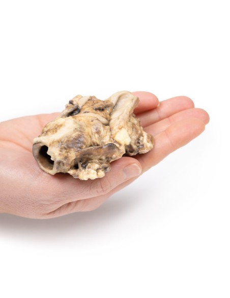 Karzinom der Fossa pyriformis - Erler Zimmer 3D anatomy Series MP2051