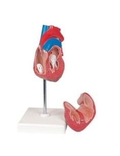 Erler Zimmer, anatomical model of heart with hypertrophy,...