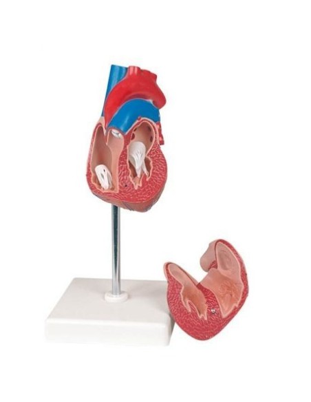 Erler Zimmer, anatomical model of heart with hypertrophy, decomposable into 2 parts G104