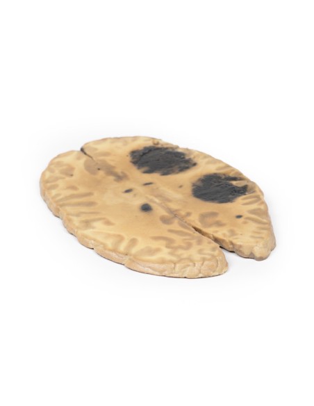 Hémorragie cérébrale secondaire à une leucémie myéloïde aiguë - Erler Zimmer 3D anatomy Series MP2009