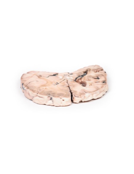 Infarto cerebral izquierdo - Erler Zimmer 3D anatomy Series MP2005