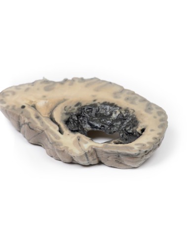 Emorragia cerebrale - Erler Zimmer 3D anatomy...