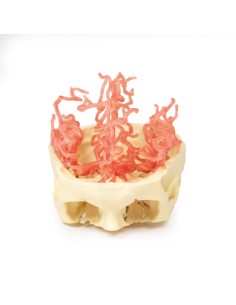 Kraniale arterielle Durchblutung - Erler Zimmer 3D...