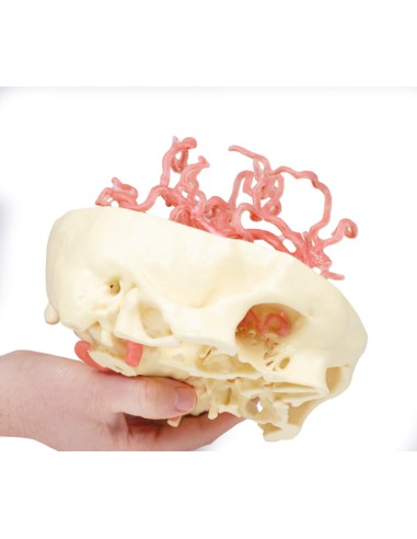 Circolazione arteriosa del cranio - Erler...