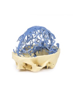 Circolazione venosa del cranio - Erler Zimmer 3D anatomy... 2