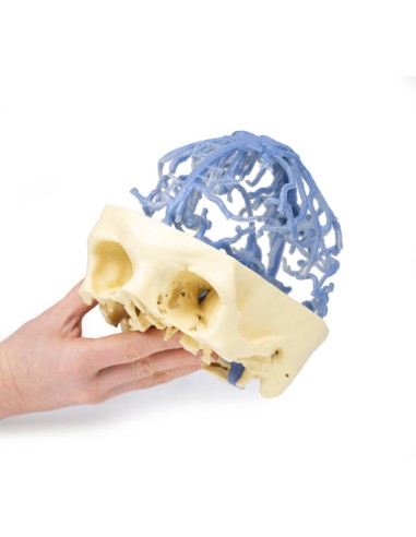 Circolazione venosa del cranio - Erler Zimmer...