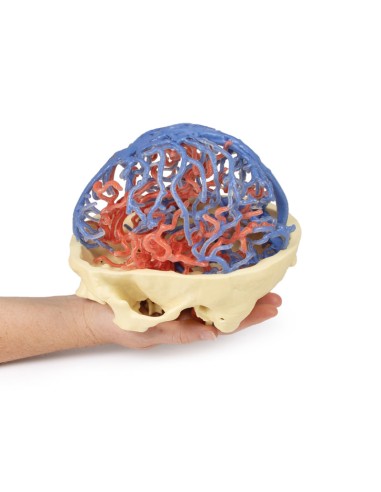 Arterial and venous circulation of the skull -...