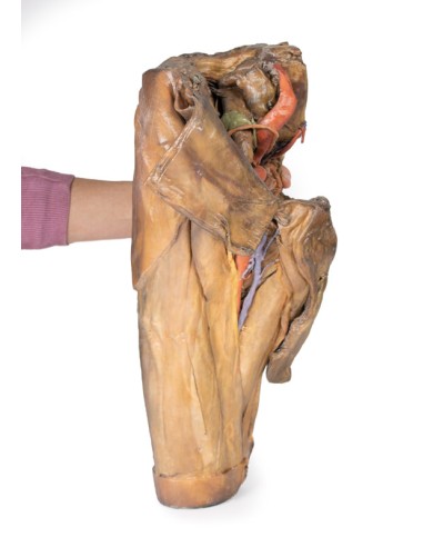 Dissection of hemipelvi and male thigh - Erler...