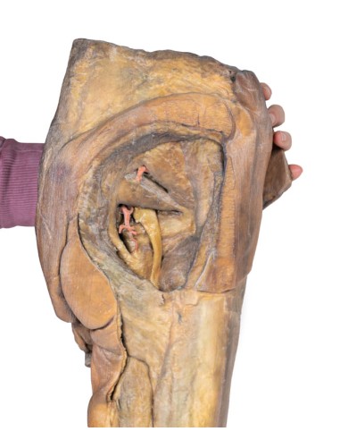 Dissektion von Hemipelvis und männlichem...