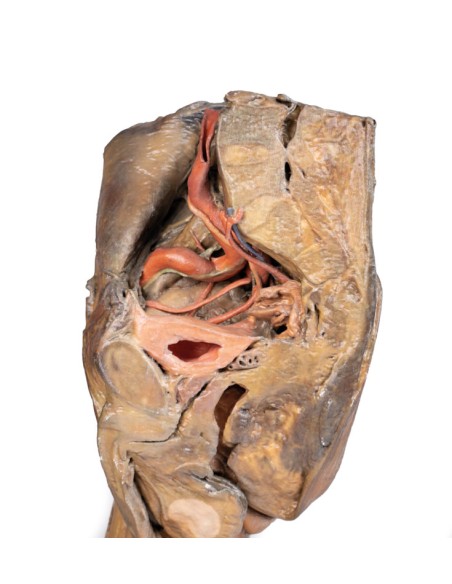 Dissection of hemipelvi and male thigh - Erler Zimmer 3D anatomy Series MP1142
