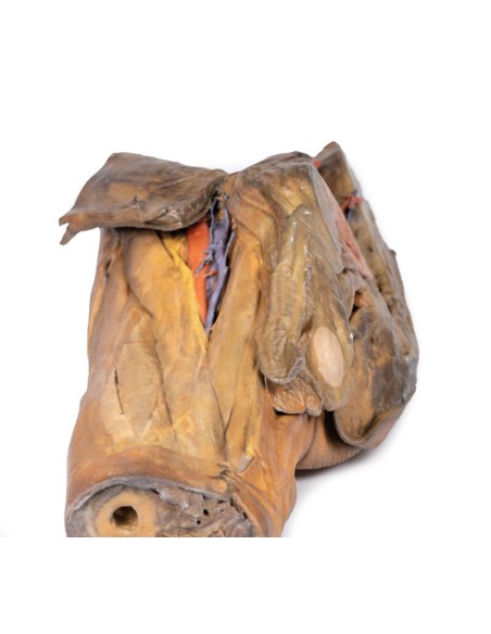 Dissektion von Hemipelvis und männlichem Oberschenkel - Erler Zimmer 3D-Anatomie Serie MP1142