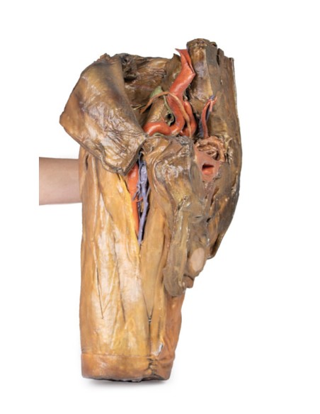 Dissektion von Hemipelvis und männlichem Oberschenkel - Erler Zimmer 3D-Anatomie Serie MP1142