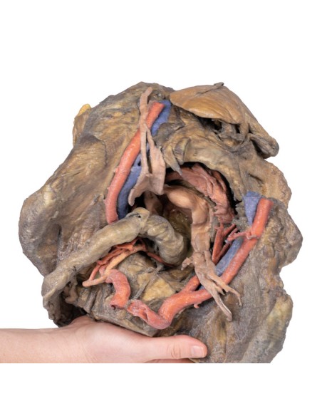 Dissection profonde du bassin féminin - Erler Zimmer 3D anatomy Series MP1141