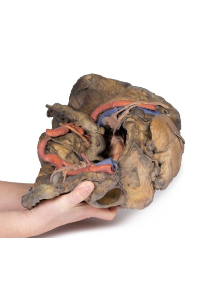 Dissezione profonda del bacino femminile - Erler Zimmer 3D anatomy Series MP1141