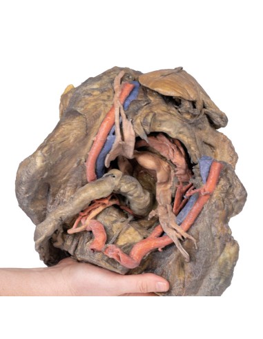 Dissection profonde du bassin féminin - Erler...