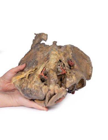 Dissection profonde du bassin féminin - Erler...