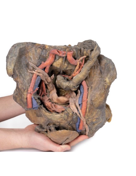 Tiefe Präparation des weiblichen Beckens - Erler Zimmer 3D Anatomie Serie MP1141