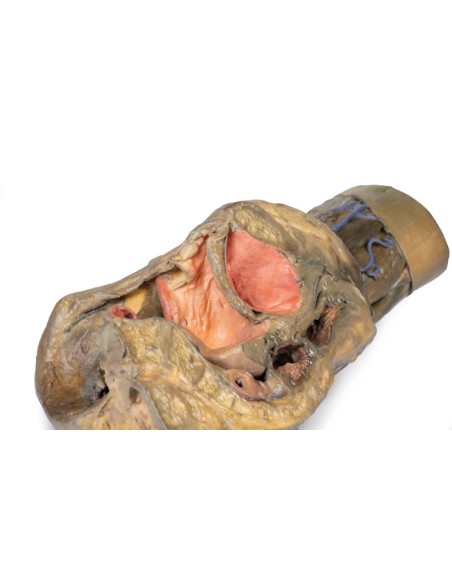 Dissezione di emipelvi e coscia femminile - Erler Zimmer 3D anatomy Series MP1140