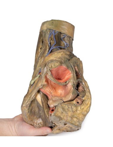 Disección de hemipelvis y muslo femenino -...