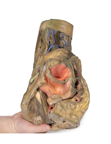 Dissection of hemipelvi and female thigh - Erler Zimmer 3D anatomy Series MP1140