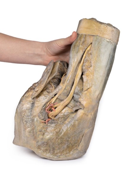 Dissection de l'hémipel et de la cuisse féminine - Erler Zimmer 3D anatomy Series MP1140