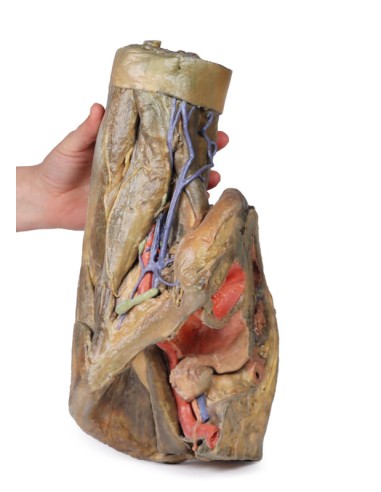 Dissektion von Hemipelvis und weiblichem...