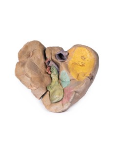 Fegato con vasi e cistifellea - Erler Zimmer 3D anatomy...