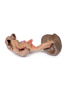 Dissection of Spleen and Pancreas - Erler Zimmer 3D...