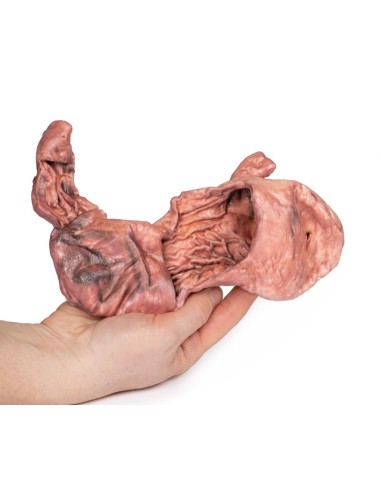 Dissezione dello stomaco - Erler Zimmer 3D...