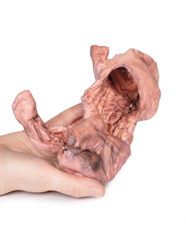 Dissection de l'estomac - Erler Zimmer 3D...
