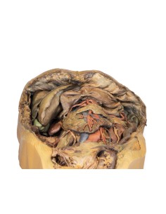 Disección del abdomen con hernia inguinal - Erler Zimmer... 2