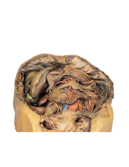 Disección del abdomen con hernia inguinal - Erler Zimmer 3D anatomy Series MP1133