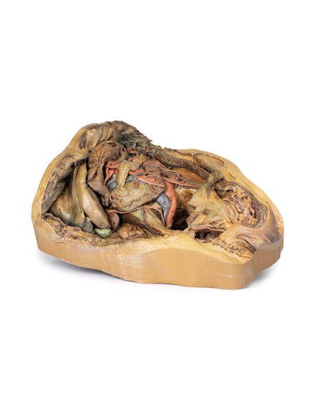 Dissektion des Abdomens mit Leistenbruch - Erler Zimmer 3D-Anatomie Serie MP1133