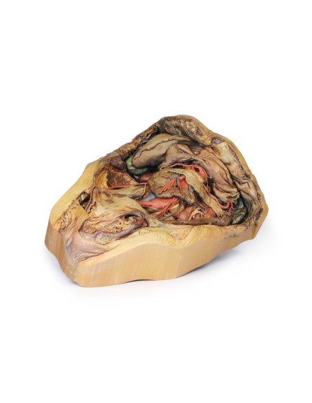 Dissezione dell'addome con ernia inguinale - Erler Zimmer 3D anatomy Series MP1133