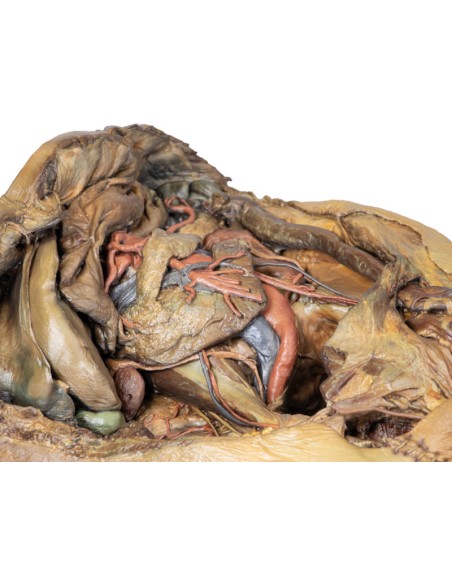 Dissezione dell'addome con ernia inguinale - Erler Zimmer 3D anatomy Series MP1133