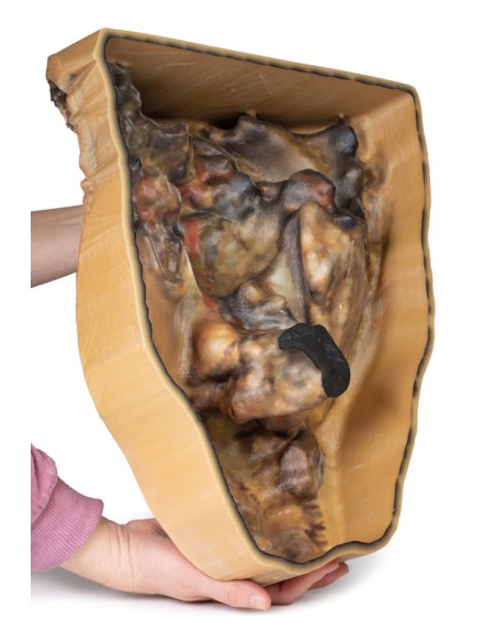 Dissezione dell'addome con ernia inguinale - Erler Zimmer 3D anatomy Series MP1133