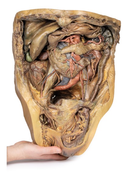 Disección del abdomen con hernia inguinal - Erler Zimmer 3D anatomy Series MP1133