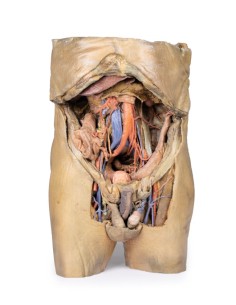 Dissektion des Abdomens mit beidseitigen Hernien - Erler...