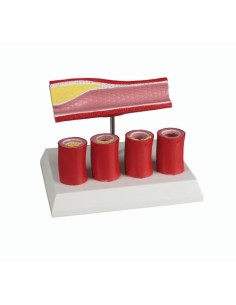 Erler Zimmer, anatomical model of artery with 4 arterial...