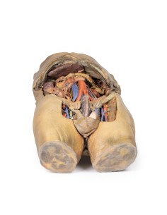 Dissection of the abdomen with bilateral hernias - Erler... 2