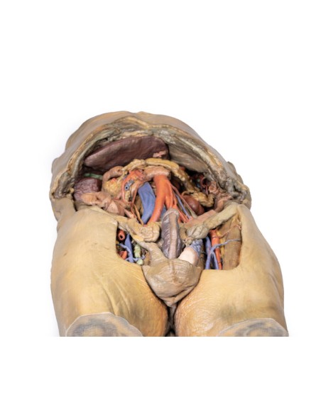 Dissektion des Abdomens mit beidseitigen Hernien - Erler Zimmer 3D anatomy Series MP1130